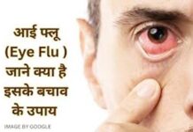 Eye flu spreading very fast, alert and guidelines issued