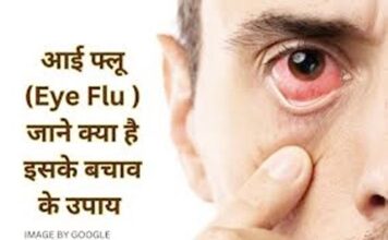 Eye flu spreading very fast, alert and guidelines issued